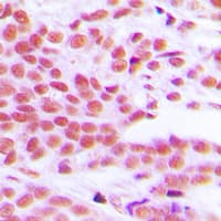 RELA / NFKB p65 Antibody (phospho-Ser529)