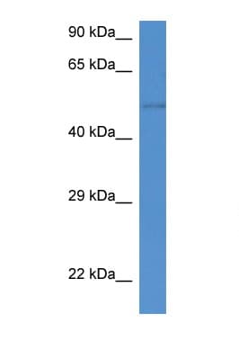 ST6GAL2 Antibody (aa286-335)
