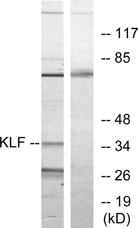 KLF / Kruppel-Like Factor Antibody (aa291-340)