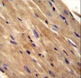 TCL / RHOJ Antibody (aa131-159)