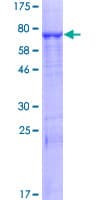Human PLB1 Protein (Recombinant GST)