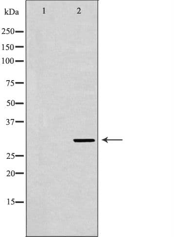 FcERI / Fc Epsilon RI Antibody