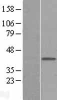 MAB21L1 Protein (Over-Expression Lysate Myc-DDK (Flag))