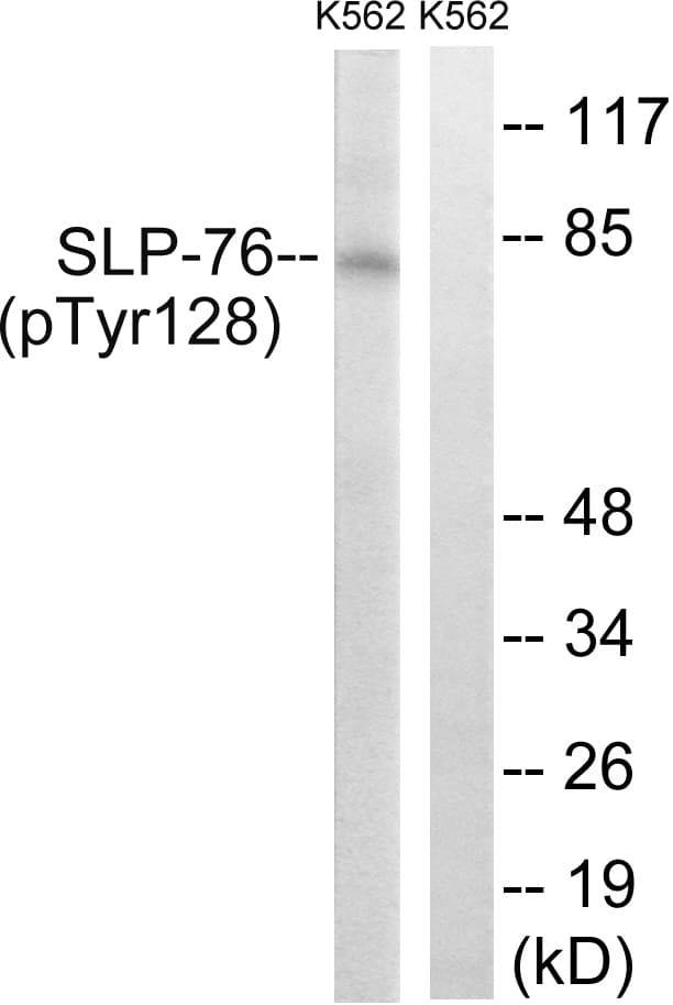 LCP2 / SLP-76 Antibody (phospho-Tyr128)