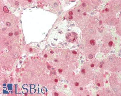 IHC-plus™ GSS / Glutathione Synthetase Antibody