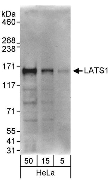 LATS1 Antibody (aa1075-C-term)