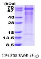 Human GAD1 / GAD67 Protein (Recombinant His)