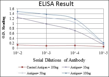 IHC-plus™ NR3C1/Glucocorticoid Receptor Antibody (clone 6E6)