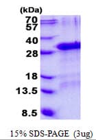 Human GFER Protein (Recombinant His)