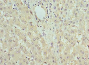 Polyclonal Rabbit anti-Human FBP1 Antibody (IHC)
