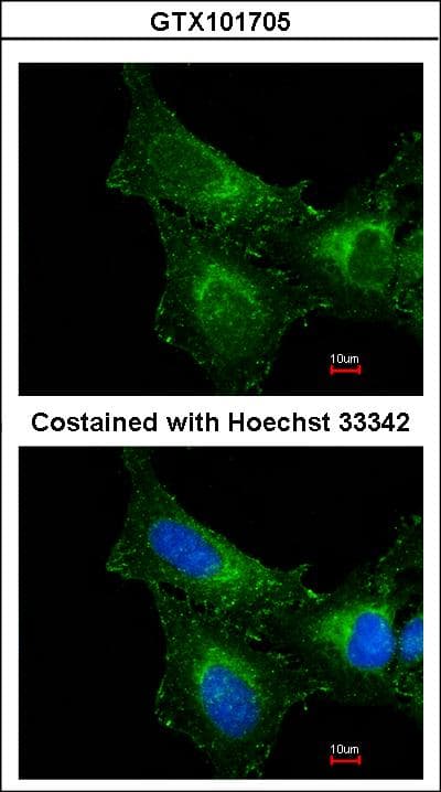 Polyclonal Rabbit anti-Human PRDX1 / Peroxiredoxin 1 Antibody (IF, WB)