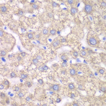 Polyclonal Rabbit anti-Human ACAT1 Antibody (IHC, IF, WB)