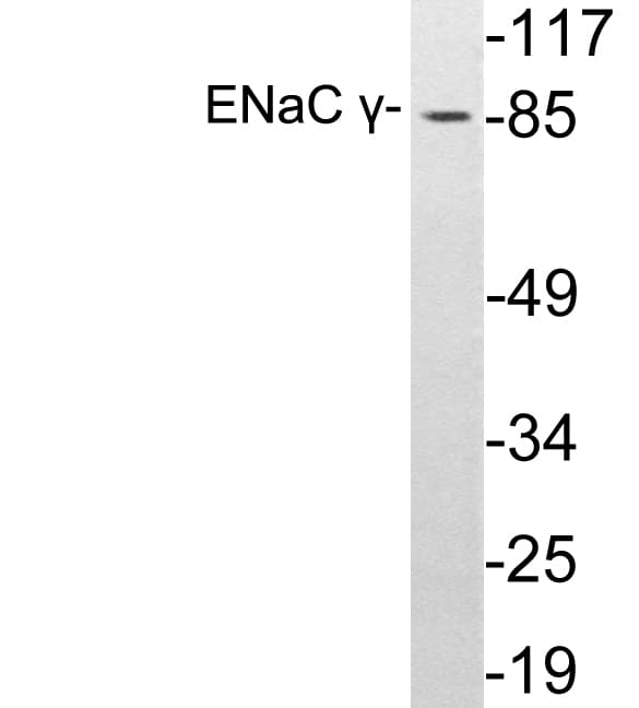 SCNN1G / ENaC Gamma Antibody (aa132-181)
