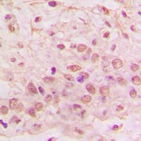 Polyclonal Rabbit anti-Human GIMAP4 Antibody (Internal, IHC, WB)