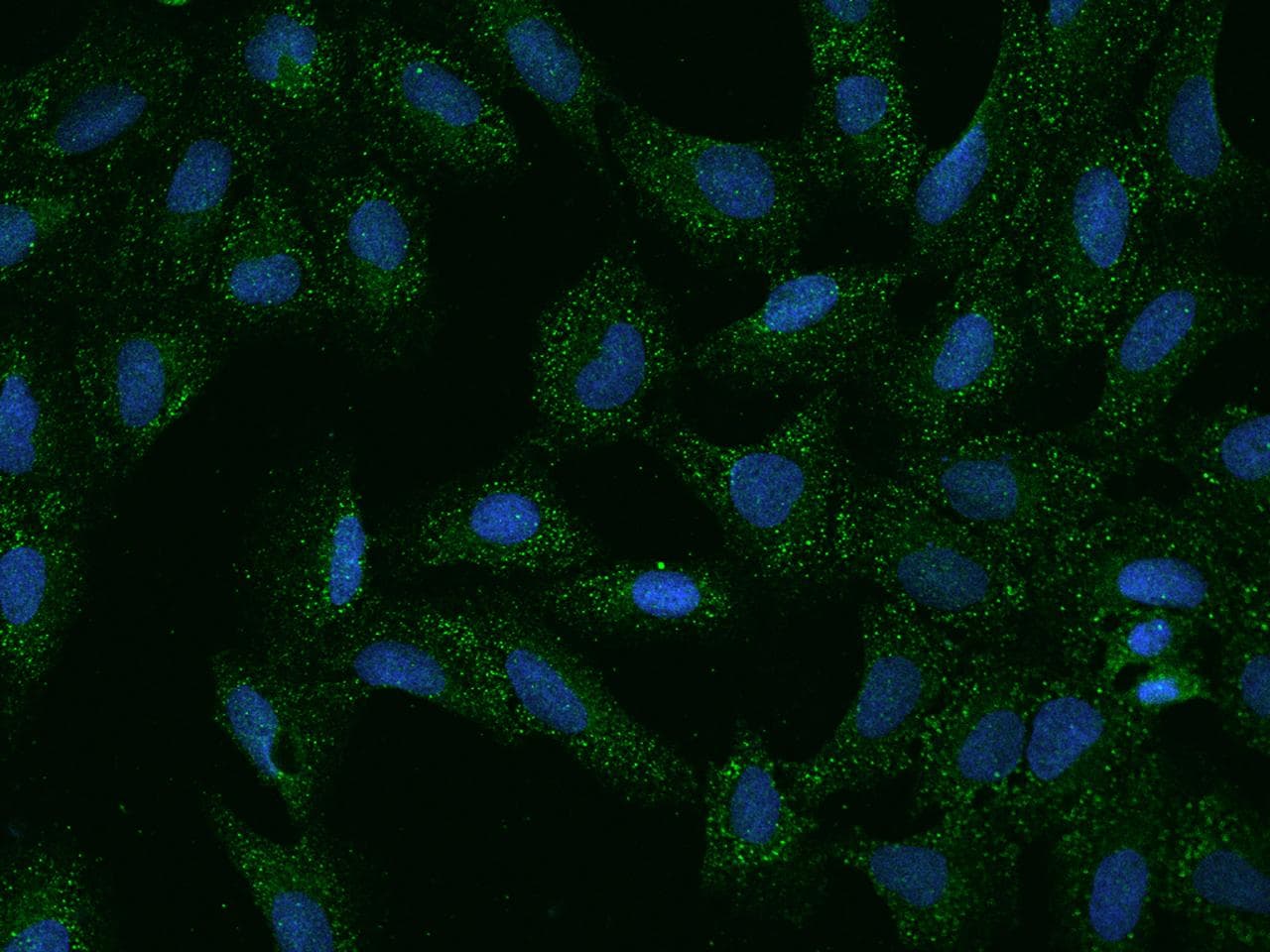 SLC35G2 Antibody
