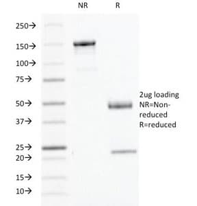 IFN Gamma / Interferon Gamma Antibody (clone IFNG/466)