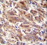 FBXW12 Antibody (aa291-320)