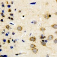 SYN1 / Synapsin 1 Antibody (N-Terminus)