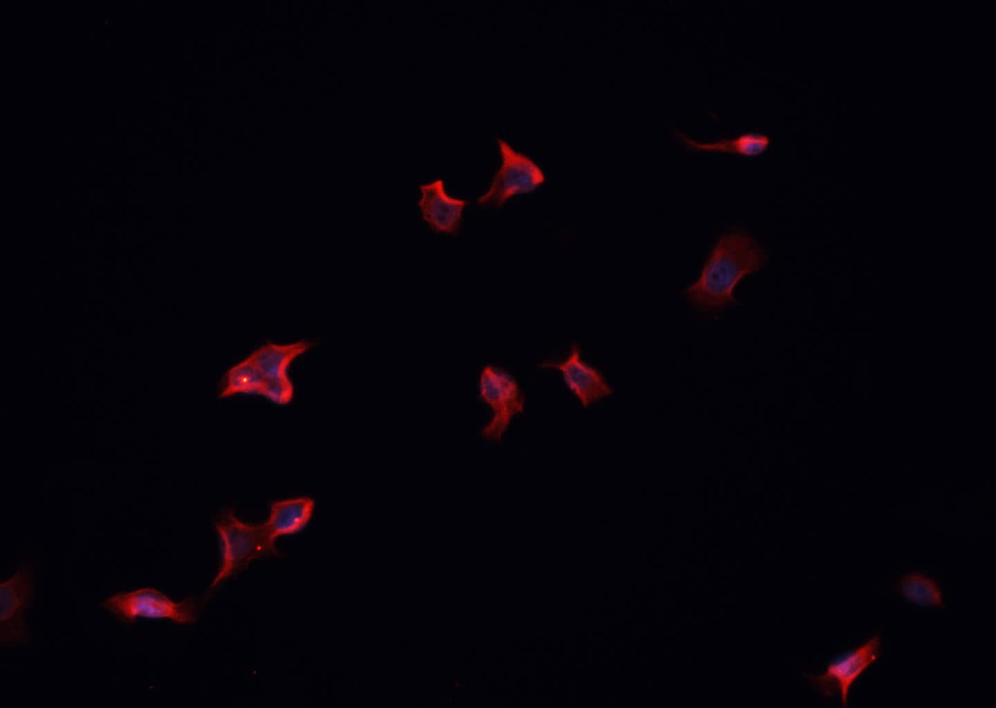 MAP4K4 Antibody