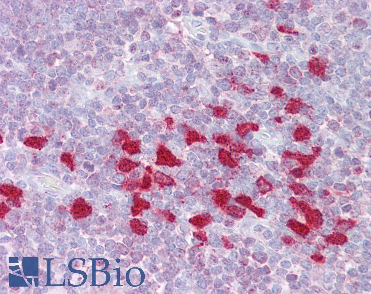 DLX5 Antibody (aa71-120)