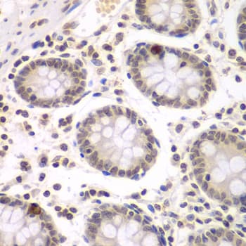 Polyclonal Rabbit anti-Human NIRF / UHRF2 Antibody (IHC, IF, WB)