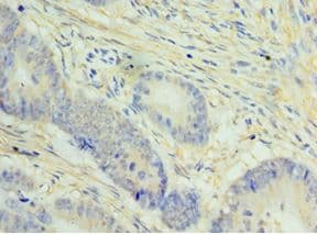NCAPH / CAP-H Antibody (aa1-250)