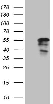 PTF1A Antibody (clone OTI3G1)