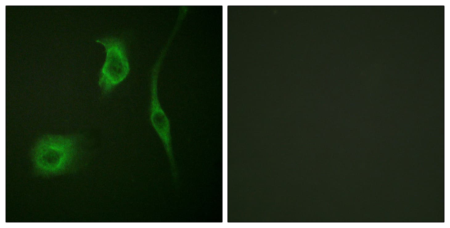 HSPB6 / HSP20 Antibody (phospho-Ser16)