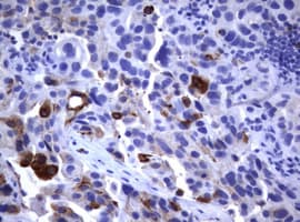 FCER2 / CD23 Antibody (clone OTI2B6)
