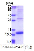 Human MIA / CD-RAP Protein (Recombinant His)