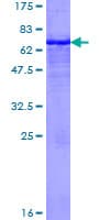 Human MICA Protein (Recombinant GST)