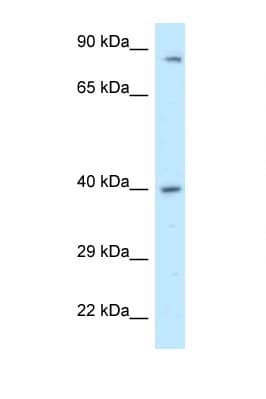 Polyclonal Rabbit anti-Human PPP2R4 Antibody (aa271-320, IHC, WB)