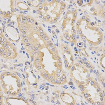 Polyclonal Rabbit anti-Human Dynactin 2 / Dynamitin Antibody (IHC, IF, WB)