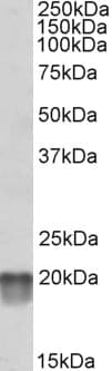 IHC-plus™ NDUFS7 Antibody (aa58-68)
