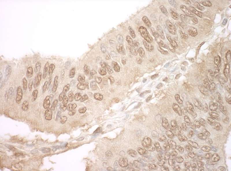 JMY Antibody (aa1-50)