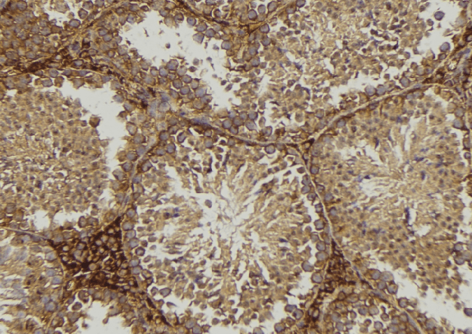 CD1D Antibody