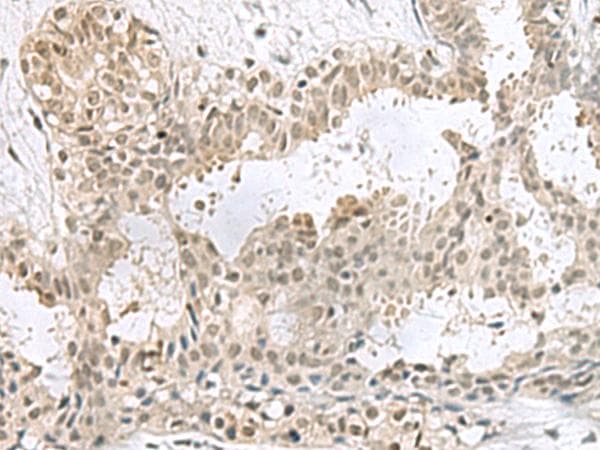 PCBD1 / PHS Antibody