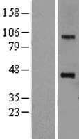 SOAT1 Protein (Over-Expression Lysate Myc-DDK (Flag))