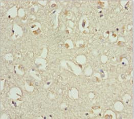 Polyclonal Rabbit anti-Human EF1B / EEF1B2 Antibody (IHC, WB)