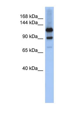 HIPK1 Antibody (aa1043-1092)