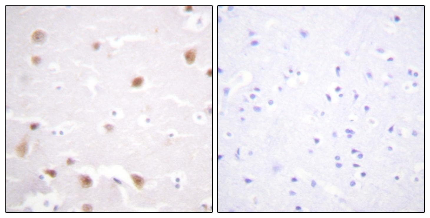 CSNK2B / Phosvitin Antibody (p209)