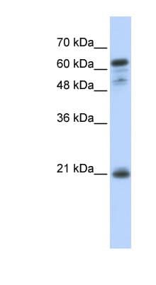 Polyclonal Rabbit anti-Human GCET2 / HGAL Antibody (C-Terminus, WB)