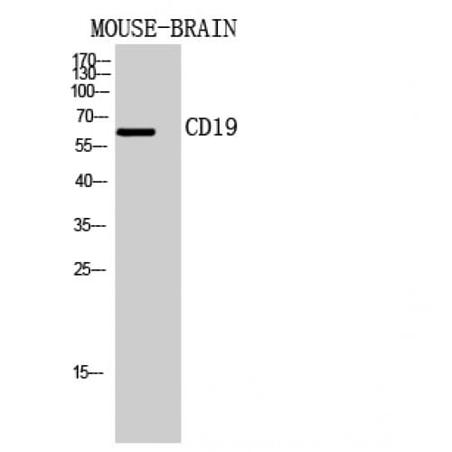 Polyclonal Rabbit anti-Human CD19 Antibody (191-240 aa, Internal, IHC, WB)