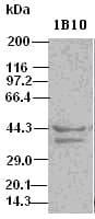 DFFA / ICAD / DFF45 Antibody (clone OTI1B10)