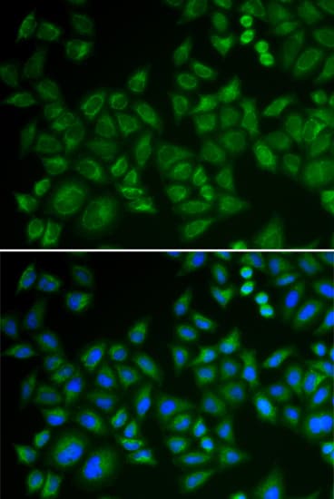 SMPD1 / Acid Sphingomyelinase Antibody (aa70-340)