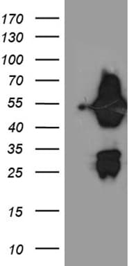 ASL / Argininosuccinate Lyase Antibody (clone OTI9G2, Carrier-free)
