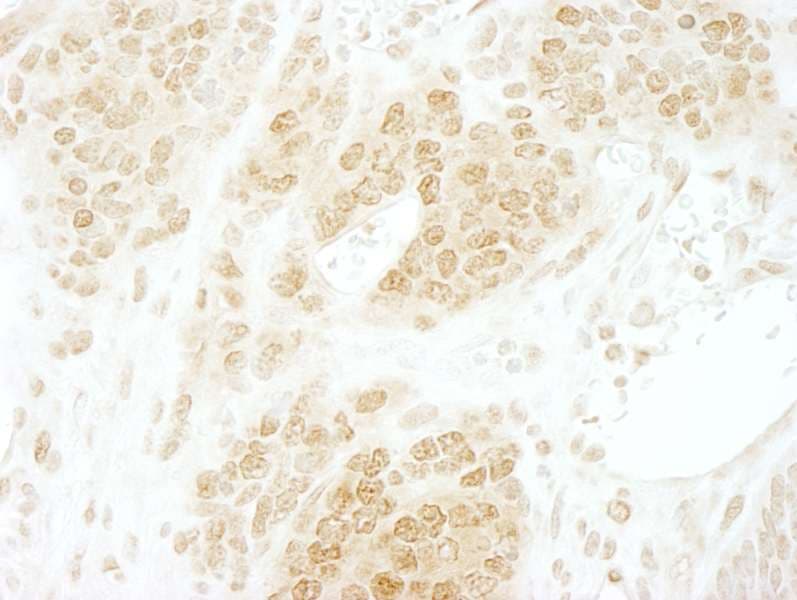 CSNK2B / Phosvitin Antibody (aa100-150)