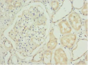 CHIA / Amcase Antibody
