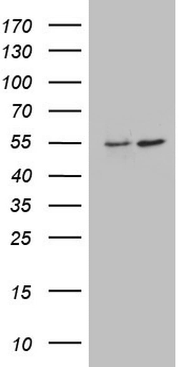 Monoclonal Mouse anti-Human ANGPTL1 Antibody (clone OTI9A7, aa24-491, WB)