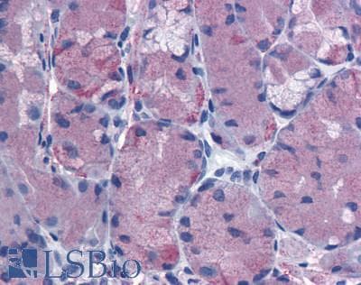 PathPlus™ CCKBR / Cckb Antibody (Extracellular Domain)